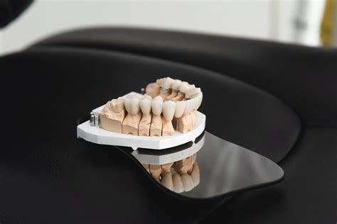 Ashford Dental Bridges .